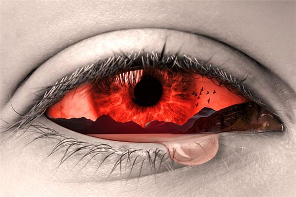 【꿈해몽】꿈에서 눈 출혈의 의미와 상징은 무엇입니까?
