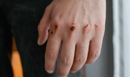 【꿈해몽】칼에 베이는 꿈은 무슨 뜻인가요? 의미와 상징, 심리 상태, 그리고 상황적 해석